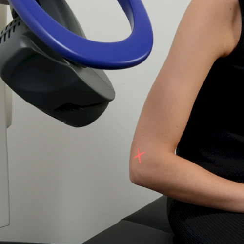MLS M6 laser applied to a client's elbow