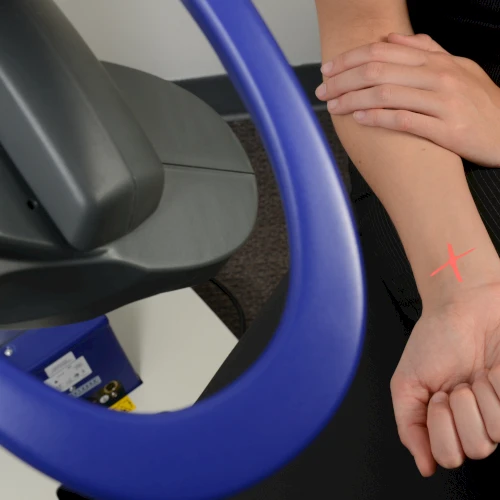 MLS M6 laser applied to a client's wrist